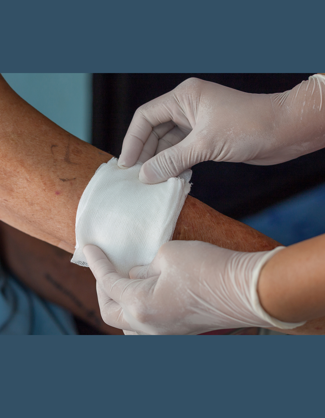 HOW TO SELECT THE RIGHT WOUND CARE PRODUCT